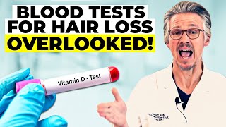 BLOOD TESTS FOR HAIR LOSS THE CRITICAL BLOOD TESTS YOU NEED NOW [upl. by Otrebmal]