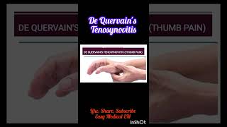 What is De Quervains TenosynovitisPhysiotherapy for Thumb Pain thumbpainshortvideo shortfeed [upl. by Htebazile]