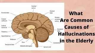 What Are Common Causes of Hallucinations in the Elderly [upl. by Azilef711]