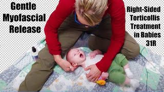 31R Gentle Myofascial Release RightSided Torticollis Treatment in Babies [upl. by Stilla]