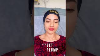 Plump Your Pout  Lip Fillers  Sarayu Clinics filler [upl. by Darrill]