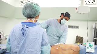 Vaser Liposuction Ameliyatı İzle  Flora Klinik [upl. by Holder]