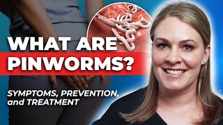 How To Treat Pinworms Symptoms Transmission Treatment amp Prevention [upl. by Odlamur407]