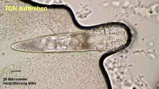 div Demodex KörperFormen zur längeren Beobachtung [upl. by Ulrich312]