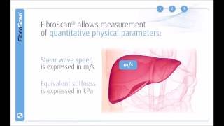 3 Stages of the FibroScan examination [upl. by Sasnak539]