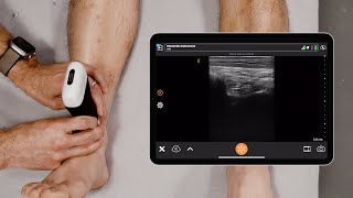 Ultrasound of the Ankle [upl. by Kall813]