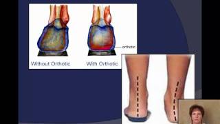 Plantar Fasciitis explained by a Podiatrist [upl. by Chap]