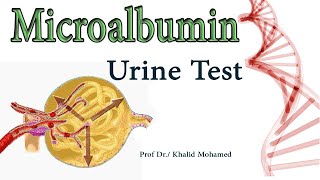 Microalbumin MA Urine Albumin Albumin to Creatinine Ratio [upl. by Eecyal]