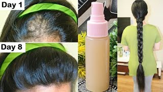 Hair Serum For Hair Growth  Aamla Hair Serum  No Hair Fall hairgrowth Hinaya [upl. by Ethe]