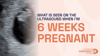 6 Weeks Pregnant Witnessing the First Heartbeat on ultrasound scan [upl. by Nnyleak]