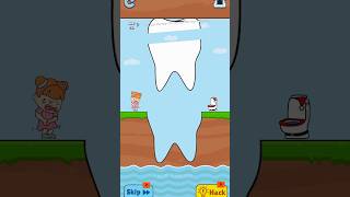 Slice this teeth🦷 to save trending viralvideo funny shorts [upl. by Gilbertina49]