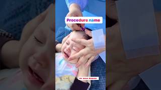 Comment the procedure name  medical procedures  IV injection  blood sample  intubationprocedure [upl. by Orms]