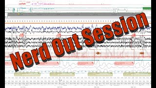 Polysomnography Nerd Out Severe OSA Fixed REM Rebound PAP Titration Progression Delta Raw Data [upl. by Atikihs241]