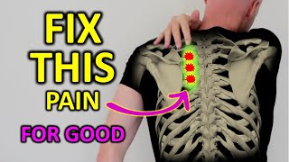 Fix Rhomboid Pain For Good Shoulder Blade Pain [upl. by Efron]