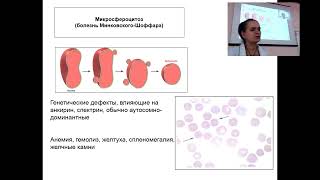 About Hemolytical anemias in 2 min [upl. by Jannelle]