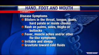 Livewell What is hand foot mouth disease [upl. by Ruscher]