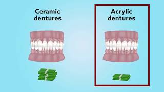 Longterm comparison of acrylic vs ceramic Allon4® fixed dentures [upl. by Gariepy]