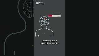 Bioelectronics explained shorts science [upl. by Amhser]