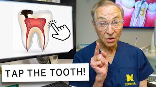 How to Tell if You Need a Root Canal DIY Test at Home [upl. by Eisned]