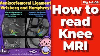 Fig 1A09 Meniscofemoral ligament Wrisberg and Humphrey [upl. by Donela]