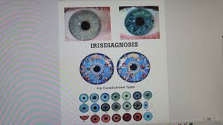 What is Iridology [upl. by Ketty]