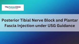 Posterior Tibial Nerve Block and Plantar Fascia Injection under USG Guidance [upl. by Clementina185]