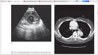 DIAGNOSTIC RADIOLOGY IMAGING [upl. by Plafker]