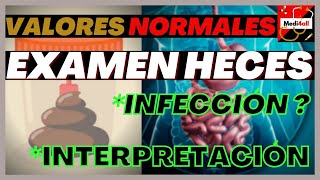 Valores Normales EXAMEN HECES Tecnica Diagnostico Infección Diarrea pH Coprologico [upl. by Eizle842]