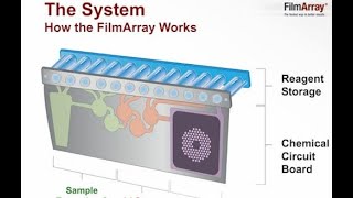 Focus on FilmArray®  CAP TODAY Webinar [upl. by Langley]