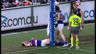 Tom Campbell vs the goalpost  AFL [upl. by Jeth]