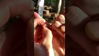 Splinter removal satisfying [upl. by Marlee]