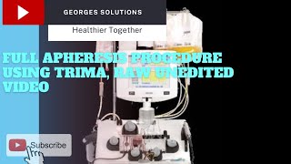 Full apheresis procedure using trima raw unedited video [upl. by Ashti913]