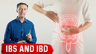 FODMAPS and Irritable Bowel Syndrome [upl. by Goar444]