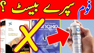 Rogaine Foam Spray 100 Result  How To Apply Monxidil Spray [upl. by Spalla]