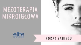 Mezoterapia mikroigłowa Wstęp do medycyny estetycznej cz I [upl. by Ayekim]