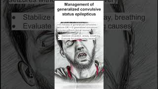 Management of generalized convulsive status epilepticus [upl. by Sisson]