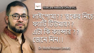 লাইপোমাফ্যাটি টিউমার ত্বকের নিচে ফ্যাটি টিউমারএটা কি ক্যান্সার জেনে নিন।। [upl. by Irolam]