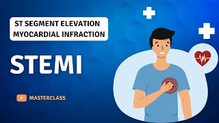 ST segment Elevation Myocardial Infraction STEMI  Masterclass [upl. by Kere]