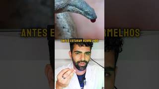 Ele apertou a cobra até sair Sngu3😱🐍🩸cobra biologia ciencia curiosidades mundoselvagem [upl. by Schonthal]