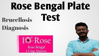 Rose Bengal Plate TestBrucellosis [upl. by Bucella828]