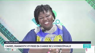 Causes diagnostic et prise en charge de lhydrocéphalie [upl. by Yrruc]