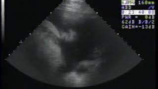 Thoroughbred Horse with Pleuropneumonia Ultrasound  Merck Veterinary Manual [upl. by Wing635]