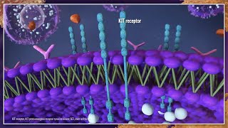 Is It Systemic Mastocytosis Best Practices for Diagnosis and Management [upl. by Andri]