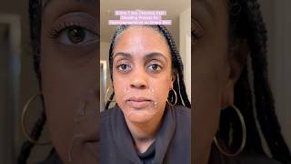 Treating Hyperpigmentation and Dark Spots on Black Skin chemicalpeel blackskincare over40skincare [upl. by Erolyat]