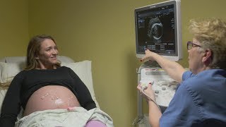 Ultrasounds during pregnancy [upl. by Tamra]