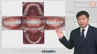 임플란트 환자에서 TTM Target Tooth Movement 왜 필요한가 [upl. by Kare684]