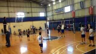 1Âº esguince de dedo jugando al Voley [upl. by Thinia]