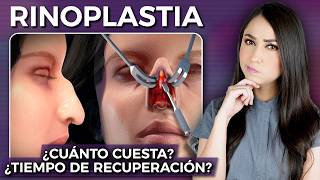 RINOPLASTÍA Cómo se realiza cuál es el costo tiempo de recuperación l Dra Pau Zúñiga👩🏻‍⚕️ [upl. by Flieger]