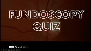 FUNDOSCOPY QUIZ  HIGH YIELD [upl. by Persson381]