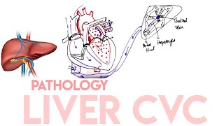 Liver CVC Congestive hepatopathy  IN EASY MANNER  Right Sided Heart Failure  Liver Necrosis [upl. by Shutz]